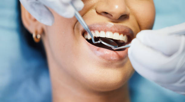 Best Emergency Dentist for Lost Fillings or Crowns in Salem, NJ