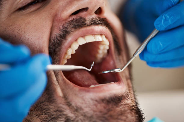 Best Emergency Dental Services for Seniors in Salem, NJ